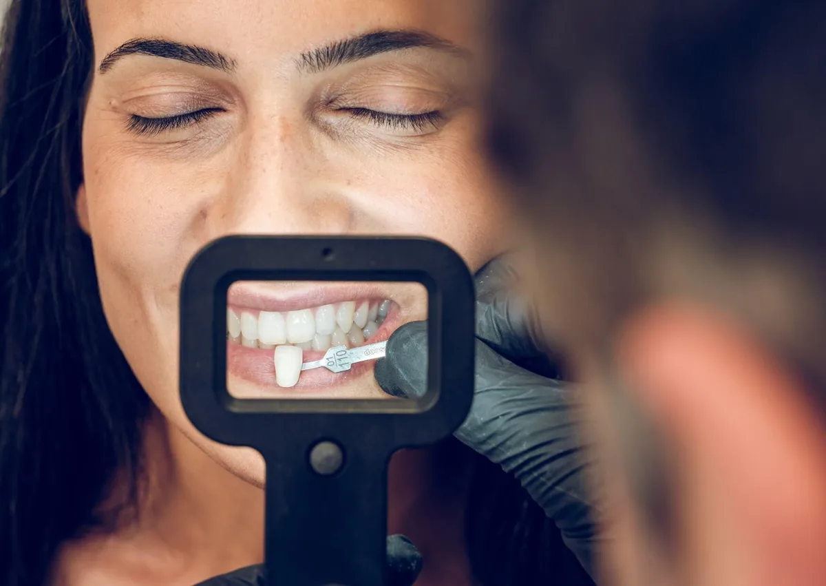 Close-up of a patient undergoing a cosmetic dentistry consultation as a dental professional uses a shade guide to match the color of her teeth.